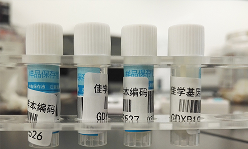 【佳学基因检测】做Bosch-Boonstra-Schaaf视神经萎缩综合征基因解码、基因检测需要多长时间? 【佳学基因检测】做Bosch-Boonstra-Schaaf视神经萎缩综合征基因解码、基因检测需要多长时间?