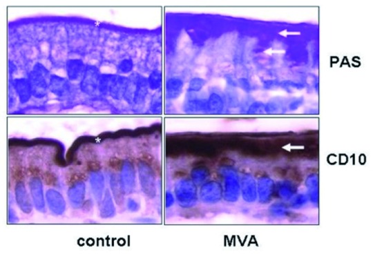 【佳学基因检测】戴维森病如何通过基因检测确诊Davidson disease? 【佳学基因检测】戴维森病如何通过基因检测确诊Davidson disease?