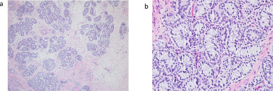 【基因检测案例】卵巢早衰7型致病基因鉴定基因解码及其个性化的调理 【基因检测案例】卵巢早衰7型致病基因鉴定基因解码及其个性化的调理