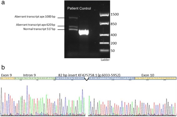 【佳学基因检测】NANA贮积病基因检测 【佳学基因检测】NANA贮积病基因检测