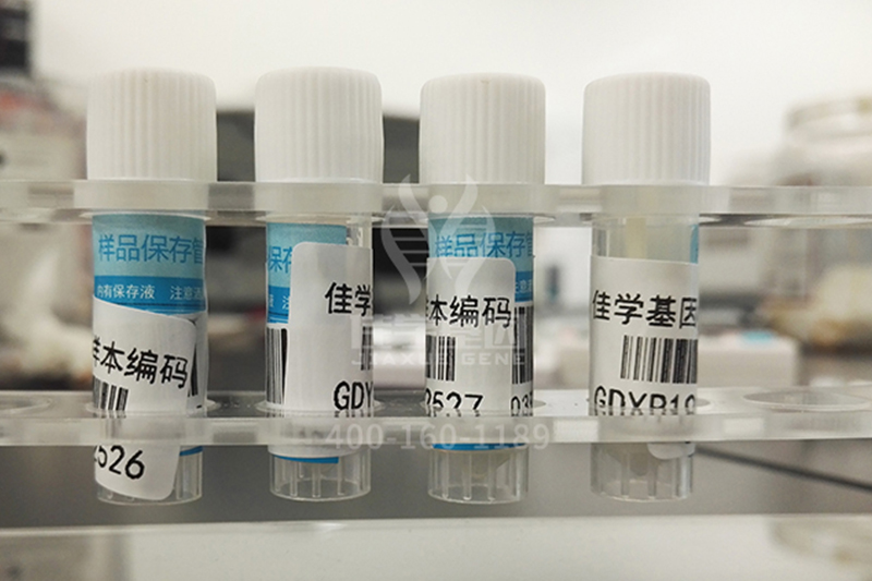 【佳学基因-基因检测】精神疾病的产生与性格特征相关吗? 【佳学基因-基因检测】精神疾病的产生与性格特征相关吗?