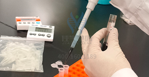 【佳学基因解码-基因检测】英国王室秃顶基因太强大，帅气的威廉王子也中招