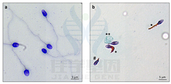 【佳学基因检测】畸形鞭毛精子症基因解码、基因检测 【佳学基因检测】畸形鞭毛精子症基因解码、基因检测
