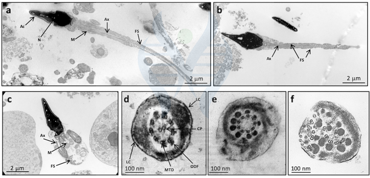 【佳学基因检测】畸形鞭毛精子症基因解码、基因检测 【佳学基因检测】畸形鞭毛精子症基因解码、基因检测