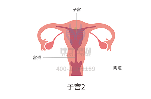 【佳学基因检测】卵巢癌基因解码、基因检测 【佳学基因检测】卵巢癌基因解码、基因检测
