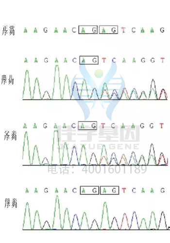 【基因检测基因解码案例】巴特综合症——佳学基因