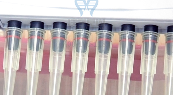 【佳学基因检测】食管鳞状细胞癌基因解码、基因检测 【佳学基因检测】食管鳞状细胞癌基因解码、基因检测